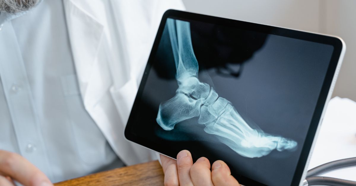 orthopedic foot and ankle surgeon Dallas, TX