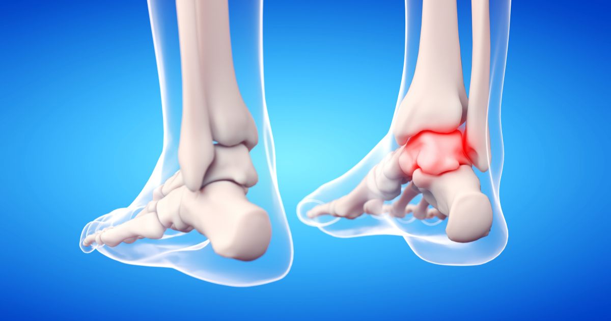 minimally invasive foot and ankle surgery​3