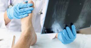 minimally invasive foot and ankle surgery​5